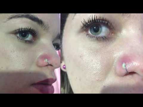 Recuperando inflamação no piercing em 3 dias cuidados