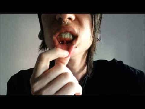 Lip Frenulum dicas de piercing