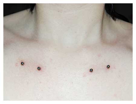 Piercing Surface Cuidados